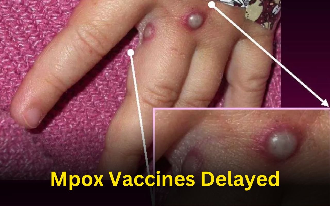 Mpox Vaccines Delayed, Outbreak in Central Africa